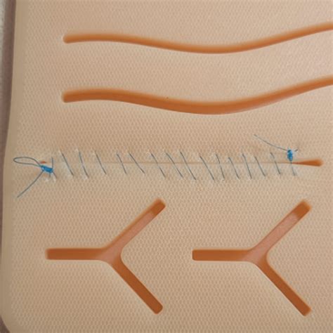 Suture Removal Kits TESTED: Which One Will Help Your Wound Heal Right?