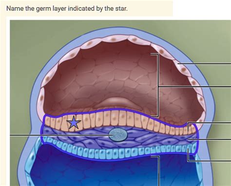 SOLVED: a. endoderm b. ectoderm c. epidermis d. mesoderm Name the germ ...