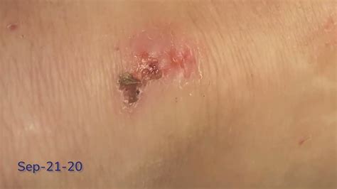 6.6 Lesson 8 Knee-Scrape Timelapse - YouTube