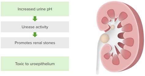 Proteus | Concise Medical Knowledge