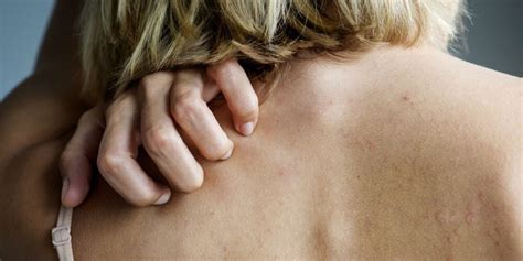 Here are the Top Reasons You Get Itchy Skin at Night - Seriable