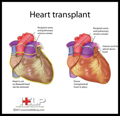 Pin on Yes, I love cardiac