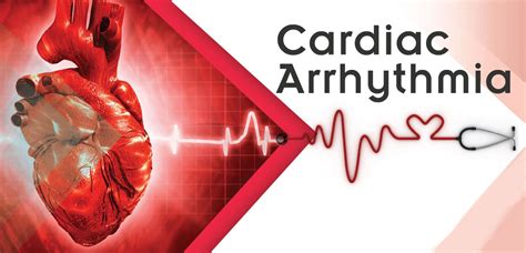 What Causes Sudden Cardiac Arrhythmia - BEST HOME DESIGN IDEAS