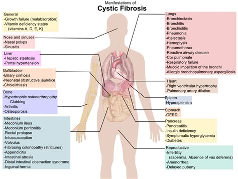 File:Cystic fibrosis manifestations.png