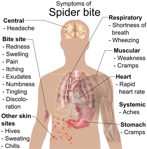 File:Symptoms of Spider bite.png - Wikipedia