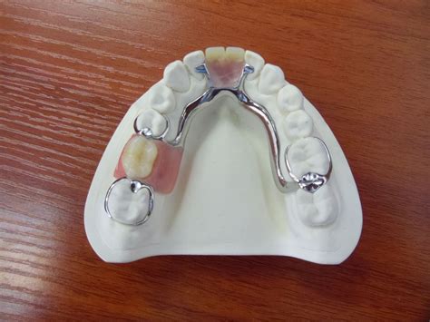 Pin on Salud dental | Partial dentures, Dental laboratory, Dental ...