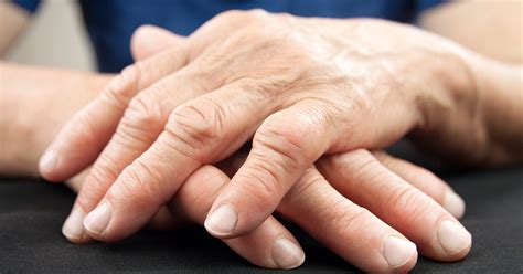 Inflammatory Arthritis: What Causes Inflammatory Osteoarthritis?