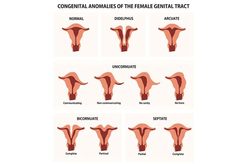 Abnormalities of the Uterus in Pregnancy – Types, Risks & Treatment