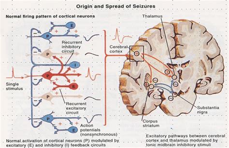 PUBLIC HEALTH: CLINICAL ASPECT OF PARTIAL EPILEPSY