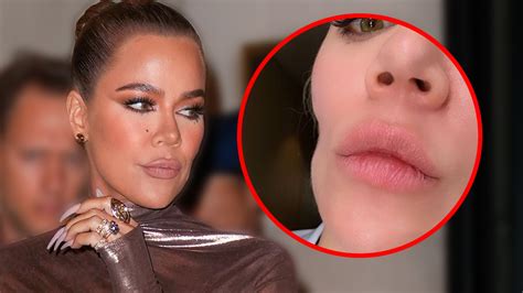 Khloe’s plastic surgery caving her face in!… | Lipstick Alley