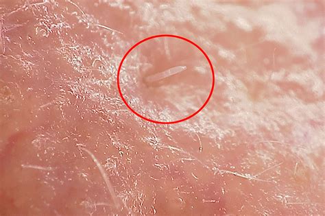 These nipple mites have sex on your face as you sleep