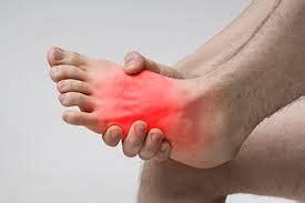 Causes of Synovitis in the Foot and Ankle - Hurst Podiatry