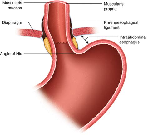 How the Lower Esophageal Sphincter and Diaphragm Prevent Reflux — Hive ...