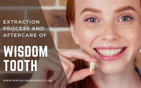 Wisdom Tooth: Extraction Process and Aftercare - Paragon Dental