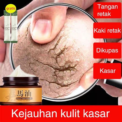 Jual ada gratisan hadiah Hand cream Obat kaki pecah dan kering Penghalus tumit kaki 30g Minyak ...