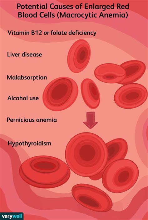 Macrocytic Anemia: Symptoms, Causes, Treatment, and More