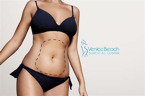 What Qualifications Should the Best Liposuction Surgeons in Los Angeles Have?