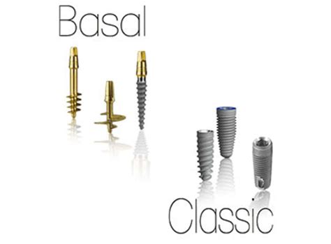 Basal Implants Delhi India Cost of Basal Dental Implants Delhi India