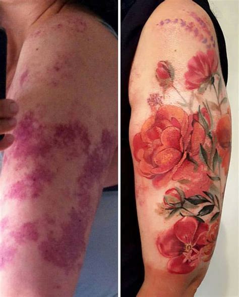 35 Genius Birthmark Cover-Up Tattoos | Bored Panda