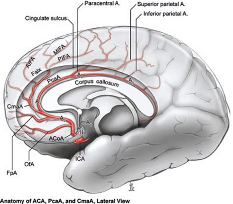 Pericallosal Artery Aneurysms | Neupsy Key