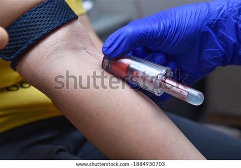 Blood Collection Using Venipuncture Technique Arm Stock Photo (Edit Now) 1884930703