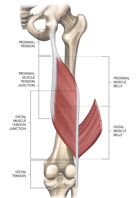 Sports Injury Bulletin - Diagnose & Treat - Intramuscular hamstring tendon injury: prognosis ...