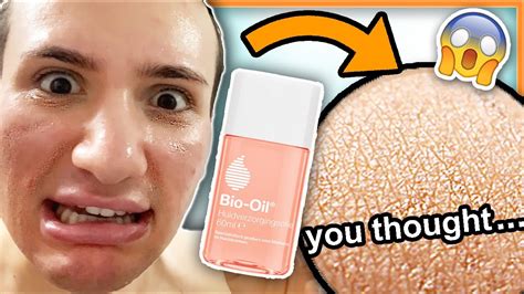 I tried BIO OIL on my face for ONE WEEK!! (my mom really thought this ...