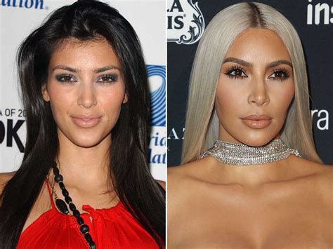 Kim Kardashian, Before and After | Kim kardashian before, Celebrities ...
