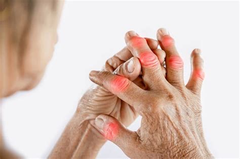 Lung cancer: The four symptoms found on your fingernails potentially warning of your risk ...