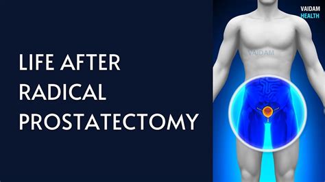 Life After Radical Prostatectomy - YouTube