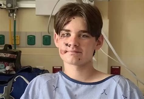 14-year-old boy miraculously survives 100ft fall into Grand Canyon - CorrectNG