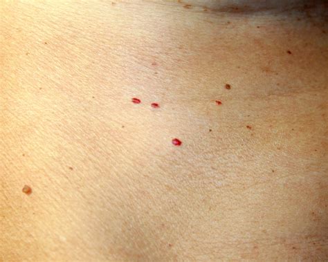 Skin Rash: 7 Causes of Red Spots and Bumps, With Pictures | Allure