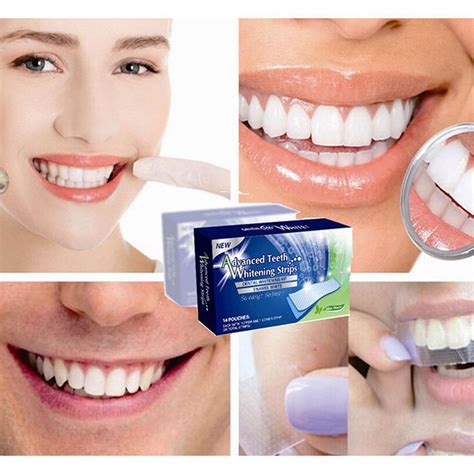 do whitening strips work on braces - Vent Cyberzine Photo Gallery