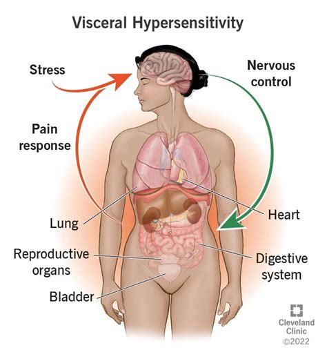 Visceral Hypersensitivity: Symptoms, Treatment, Causes & What it Is (2022)