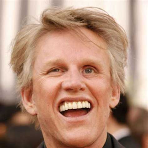 Gary Busey Teeth