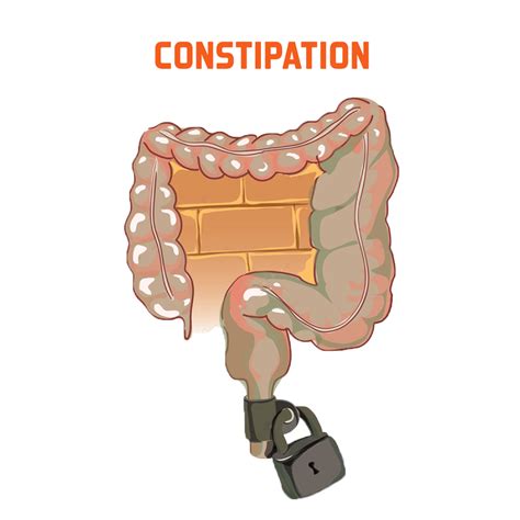 Gastro Symptoms - Stomach Pain, Ulcer, Jaundice, Reflux Symptoms and Treatment