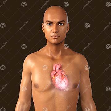 Human Heart Anatomy, 3D Illustration. Concept of Heart Disease. Coronary Artery Disease ...