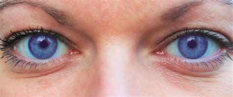 Is it really possible for people to have purple eyes? - Glasses Direct Blog