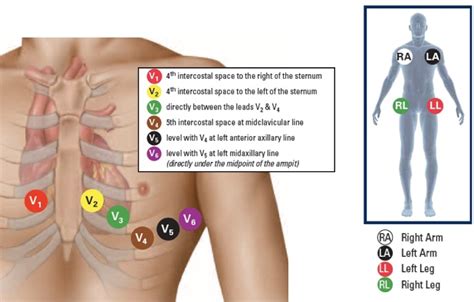 Ecg Placement Leads Diagram