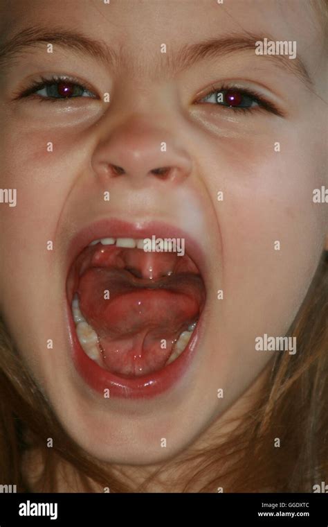 child with mouth open Stock Photo - Alamy