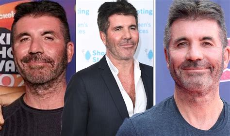 Simon Cowell's surgery to achieve ageless face 'hurt like hell' before ...