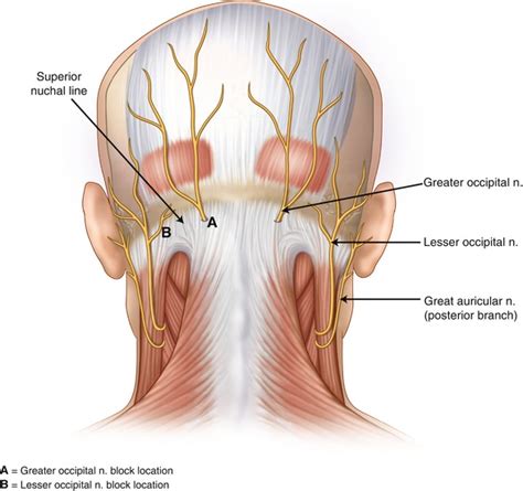 Back of head pain