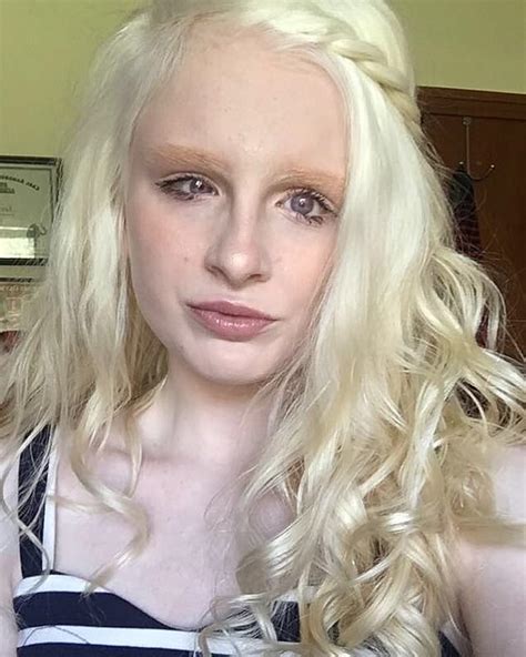 Albino woman becomes TikTok star thanks to VIOLET-COLORED EYES - users call her 'supernatural ...