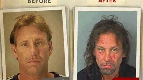 PHOTOS: Before and after 'faces of addiction' pictures show impact of drugs on men, women