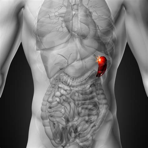 ITP patient perceptions on splenectomy outcomes | ITP Australia and New Zealand