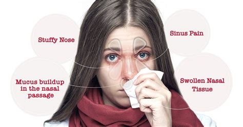 Home Treatments for Nasal Congestion and Sinus Pressure | Westside Head ...