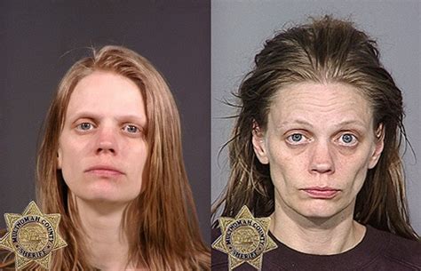 Meth Addicts Before And After Drugs – Telegraph