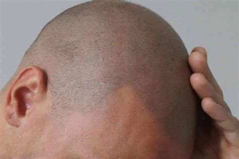 A Guide to Hairline Tattoos | Man of Many | Hairline tattoos, Hair tattoo men, Fake hair