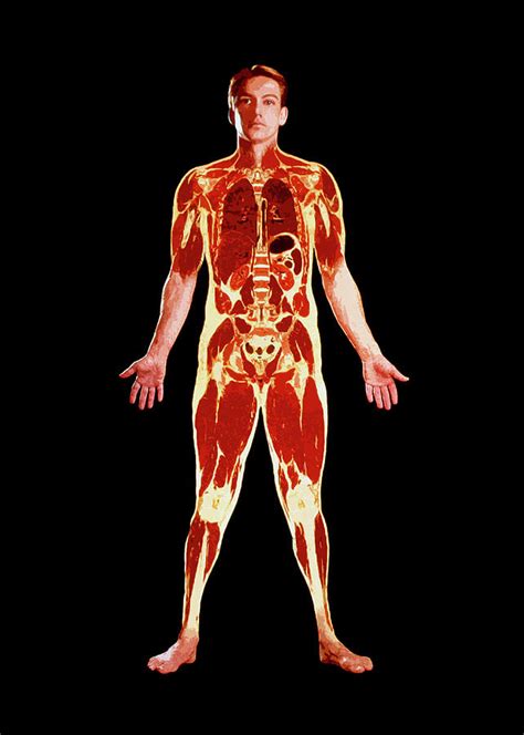 Visible Human Project: Sectioned Male Body (front) #1 Photograph by Mehau Kulyk/science Photo ...