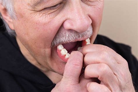 Loose Dentures and the Problems They Cause - Gordon Dental Implants & Cosmetics